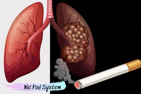 Hút thuốc lá ảnh hưởng tới phổi